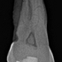 CI93.jpg