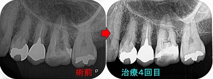 2025 EEdental HYA (2).jpg