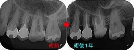 2025 EEdental HYA (4).jpg