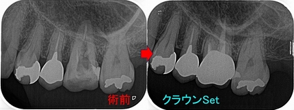 2025 EEdental HYA (6).jpg
