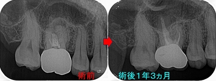 2025 EEdental IN (4).jpg