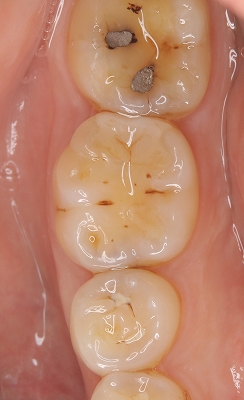 2025 EEdental Tm (4).jpg