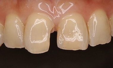2025 EEdental KTI (2).jpg