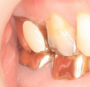 2025 EEdental YAH (5).jpg