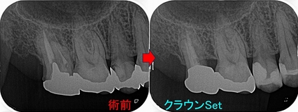 2025 EEdental YAH (6).jpg