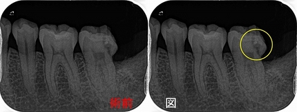2026 EEdental TAY (1).jpg