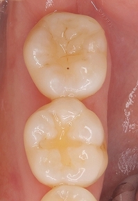 2026 EEdental TAY (4).jpg