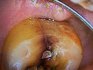 2026 EEdental US(1).jpg