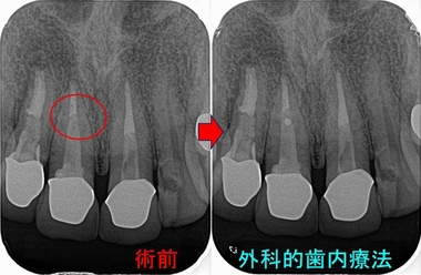 2026 EEdental HAT (2).jpg