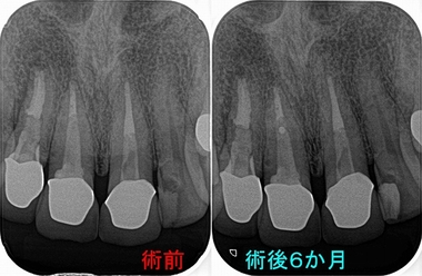 2026 EEdental HAT (3).jpg