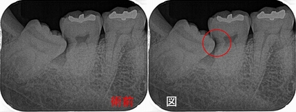 2026 EEdental MIH (1).jpg