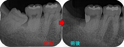 2026 EEdental MIH (2).jpg