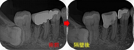 2026 EEdental TAK2 (2).jpg