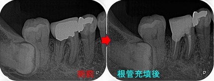 2026 EEdental TAK2 (3).jpg