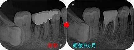 2026 EEdental TAK2 (4).jpg