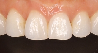 2026 EEdental HAM (4).jpg