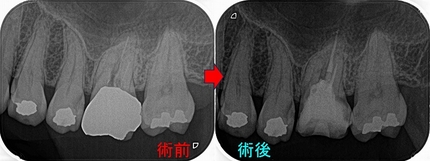 2026 EEdental HOT (2).jpg
