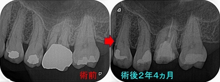 2026 EEdental HOT (4).jpg