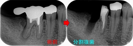 2026 EEdental FUD (4).jpg