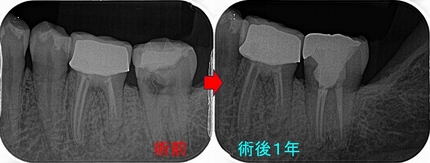 2026 EEdental IZY.jpg