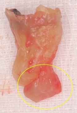 2026 EEdental SUM.jpg