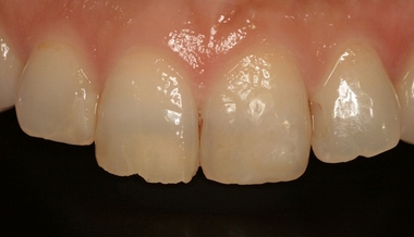 2015 EEdental (1).jpg