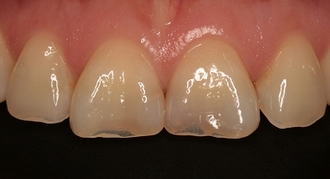 2026 EEdental FUE (1).jpg