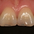 2026 EEdental FUE (1).jpg