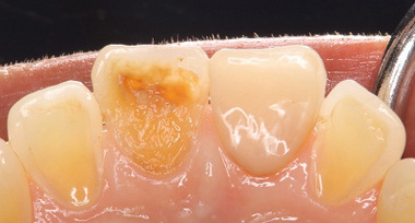 2026 EEdental FUE (2).jpg