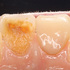2026 EEdental FUE (2).jpg