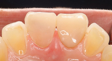 2026 EEdental FUE (3).jpg