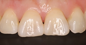 2026 EEdental FUE (4).jpg