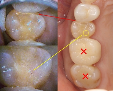 2026 EEdental ISM (1).jpg