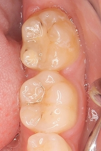 2026 EEdental TET (1).jpg