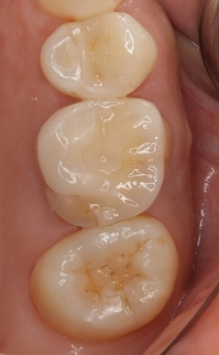 2026 EEdental HAY (1).jpg