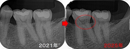 2026 EEdental SIN (2).jpg