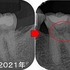 2026 EEdental SIN (2).jpg