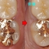 2026 EEdental TAA (3).jpg