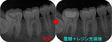 2026 EEdental TEZ (1).jpg
