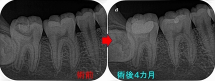 2026 EEdental TEZ (2).jpg