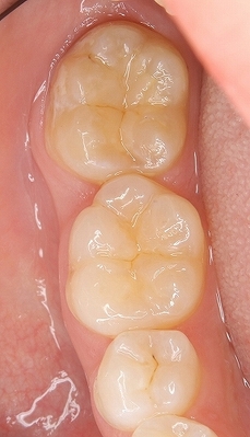 2026 EEdental TEZ (3).jpg