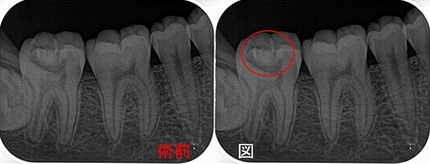 2026 EEdental TEZ (4).jpg