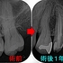 2026EEdental TKA (4).jpg