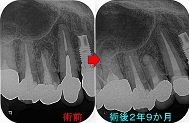 2026 EEdental HTO (2).jpg