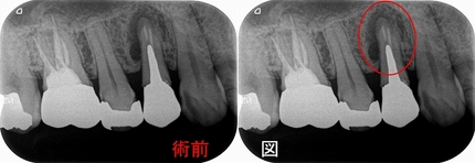 2026 EEdental EEdental TMI (1).jpg