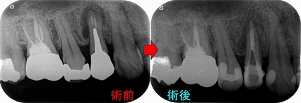 2026 EEdental EEdental TMI (2).jpg