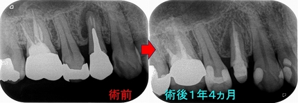 2026 EEdental EEdental TMI (3).jpg