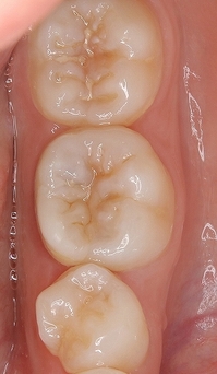 2026 EEdental NON (4).jpg